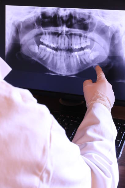 Best Emergency Treatment for Dental Infections or Abscesses in Silver Lake, OH