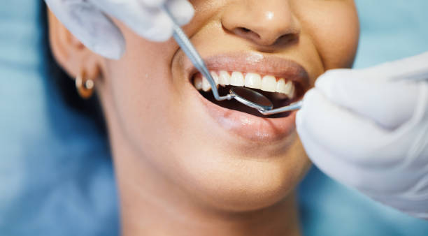 Best Same-Day Emergency Dental Services in Silver Lake, OH
