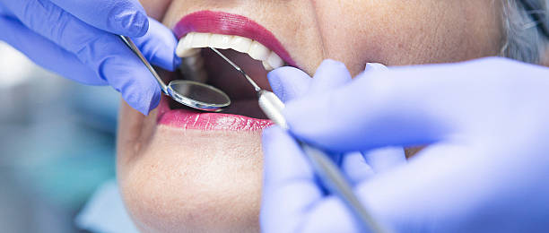 Best Emergency Dental Care for Broken or Chipped Teeth in Silver Lake, OH